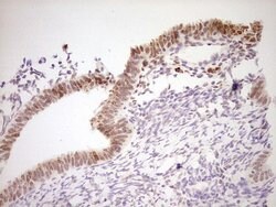 Invitrogen NOR-1 Monoclonal Antibody (OTI5C2) 100 &mu;L; Unconjugated:Antibodies,