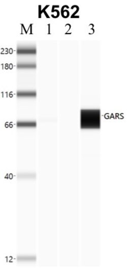 Invitrogen GARS Monoclonal Antibody (OTI6C5) 100 &mu;L | Buy Online | Invitrogen&trade; | Fisher Scientific