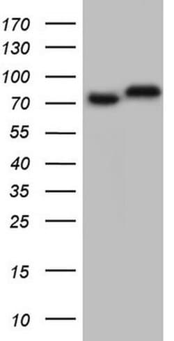 Invitrogen GARS Monoclonal Antibody (OTI6C5) 100 &mu;L | Buy Online | Invitrogen&trade; | Fisher Scientific
