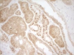Invitrogen MKL1 Monoclonal Antibody (OTI3G7) 100 &mu;L; Unconjugated:Antibodies,
