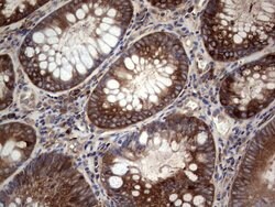 Invitrogen GARS Monoclonal Antibody (OTI4G4) 100 &mu;L; Unconjugated:Antibodies,