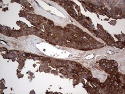 Invitrogen GARS Monoclonal Antibody (OTI4G4) 100 &mu;L; Unconjugated:Antibodies,
