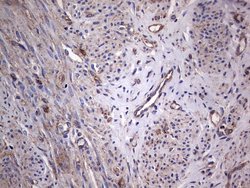 Invitrogen GARS Monoclonal Antibody (OTI4G4) 100 &mu;L; Unconjugated:Antibodies,