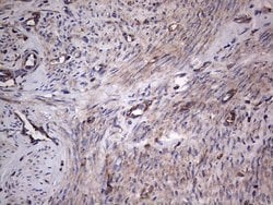 Invitrogen GARS Monoclonal Antibody (OTI4G4) 100 &mu;L; Unconjugated:Antibodies,