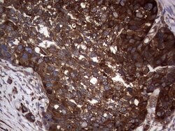 Invitrogen GARS Monoclonal Antibody (OTI4G4) 100 &mu;L; Unconjugated:Antibodies,