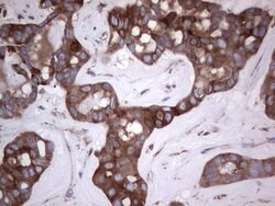 Invitrogen GARS Monoclonal Antibody (OTI4G4) 100 &mu;L; Unconjugated:Antibodies,