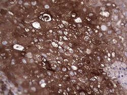 Invitrogen GARS Monoclonal Antibody (OTI4G4) 100 &mu;L; Unconjugated:Antibodies,