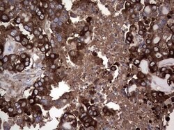 Invitrogen GARS Monoclonal Antibody (OTI4G4) 100 &mu;L; Unconjugated:Antibodies,