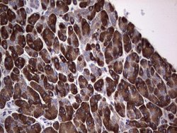 Invitrogen GARS Monoclonal Antibody (OTI4G4) 100 &mu;L; Unconjugated:Antibodies,