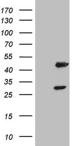 Invitrogen MB67 Monoclonal Antibody (OTI2H10) 100 &mu;L; Unconjugated:Antibodies,
