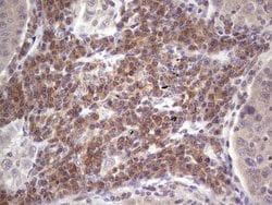 Invitrogen Aspartoacylase Monoclonal Antibody (OTI2D2) 100 &mu;L; Unconjugated:Antibodies,