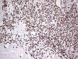Invitrogen HDAC9 Monoclonal Antibody (OTI7G2) 100 &mu;L; Unconjugated:Antibodies,