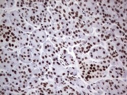 Invitrogen HDAC9 Monoclonal Antibody (OTI7G2) 100 &mu;L; Unconjugated:Antibodies,