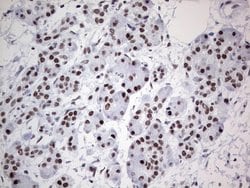Invitrogen HDAC9 Monoclonal Antibody (OTI7G2) 100 &mu;L; Unconjugated:Antibodies,