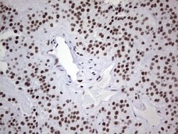 Invitrogen HDAC9 Monoclonal Antibody (OTI7G2) 100 &mu;L; Unconjugated:Antibodies,
