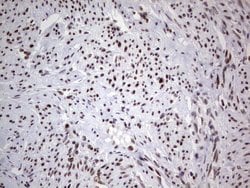 Invitrogen HDAC9 Monoclonal Antibody (OTI7G2) 100 &mu;L; Unconjugated:Antibodies,