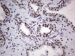 Invitrogen HDAC9 Monoclonal Antibody (OTI7G2) 100 &mu;L; Unconjugated:Antibodies,