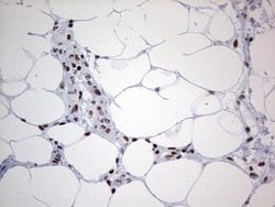Invitrogen HDAC9 Monoclonal Antibody (OTI7G2) 100 &mu;L; Unconjugated:Antibodies,