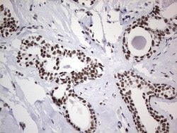 Invitrogen HDAC9 Monoclonal Antibody (OTI7G2) 100 &mu;L; Unconjugated:Antibodies,
