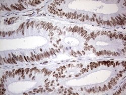 Invitrogen HDAC9 Monoclonal Antibody (OTI7G2) 100 &mu;L; Unconjugated:Antibodies,