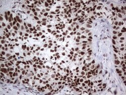 Invitrogen HDAC9 Monoclonal Antibody (OTI7G2) 100 &mu;L; Unconjugated:Antibodies,