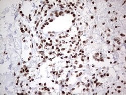 Invitrogen HDAC9 Monoclonal Antibody (OTI7G2) 100 &mu;L; Unconjugated:Antibodies,