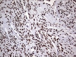 Invitrogen hnRNP L Monoclonal Antibody (OTI9G7) 100 &mu;L; Unconjugated:Antibodies,