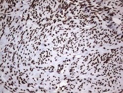 Invitrogen hnRNP L Monoclonal Antibody (OTI9G7) 100 &mu;L; Unconjugated:Antibodies,