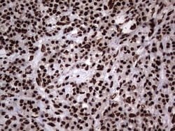 Invitrogen hnRNP L Monoclonal Antibody (OTI9G7) 100 &mu;L; Unconjugated:Antibodies,