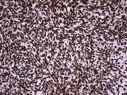 Invitrogen hnRNP L Monoclonal Antibody (OTI9G7) 100 &mu;L; Unconjugated:Antibodies,