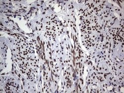 Invitrogen TLK2 Monoclonal Antibody (OTI2G1) 100 &mu;L; Unconjugated:Antibodies,