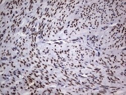Invitrogen TLK2 Monoclonal Antibody (OTI2G1) 100 &mu;L; Unconjugated:Antibodies,
