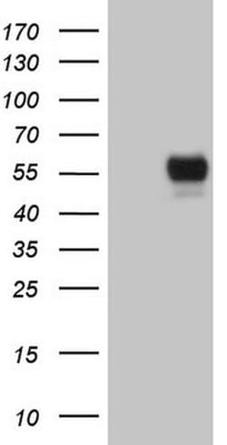 Invitrogen GFI1 Monoclonal Antibody (OTI6E8) 100 &mu;L; Unconjugated:Antibodies,