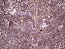 Invitrogen PRKD3 Monoclonal Antibody (OTI3D8) 100 &mu;L; Unconjugated:Antibodies,