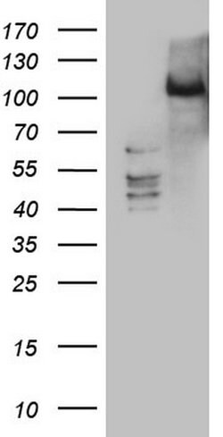 Invitrogen PRKD3 Monoclonal Antibody (OTI3D8) 100 &mu;L; Unconjugated:Antibodies,