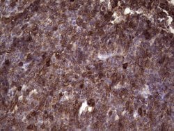 Invitrogen ANGPTL1 Monoclonal Antibody (OTI1B2) 100 &mu;L; Unconjugated:Antibodies,