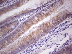 Invitrogen PRKD3 Monoclonal Antibody (OTI4G6) 100 &mu;L; Unconjugated:Antibodies,