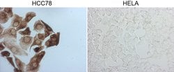 Invitrogen ROS1 Monoclonal Antibody (OTI1A1) 100 &mu;L; Unconjugated:Antibodies,