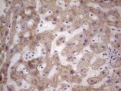 Invitrogen LRRC6 Monoclonal Antibody (OTI2A8) 100 μL; Unconjugated:Antibodies,