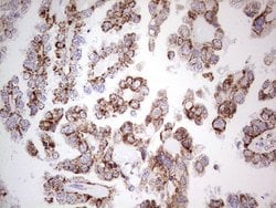 Invitrogen LRRC6 Monoclonal Antibody (OTI2F8) 100 &mu;L; Unconjugated:Antibodies,