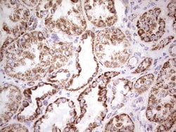 Invitrogen LRRC6 Monoclonal Antibody (OTI2F8) 100 &mu;L; Unconjugated:Antibodies,