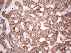 Invitrogen LRRC6 Monoclonal Antibody (OTI2F8) 100 &mu;L; Unconjugated:Antibodies,
