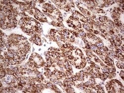 Invitrogen LRRC6 Monoclonal Antibody (OTI2F8) 100 &mu;L; Unconjugated:Antibodies,