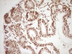 Invitrogen LPIN1 Monoclonal Antibody (OTI8F10) 100 &mu;L; Unconjugated:Antibodies,
