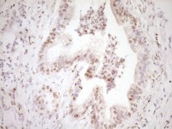 Invitrogen LPIN1 Monoclonal Antibody (OTI8F10) 100 &mu;L; Unconjugated:Antibodies,