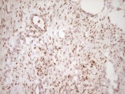 Invitrogen LPIN1 Monoclonal Antibody (OTI8F10) 100 &mu;L; Unconjugated:Antibodies,