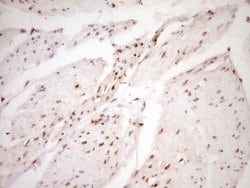 Invitrogen LPIN1 Monoclonal Antibody (OTI8F10) 100 &mu;L; Unconjugated:Antibodies,