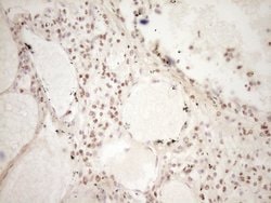 Invitrogen LPIN1 Monoclonal Antibody (OTI8F10) 100 &mu;L; Unconjugated:Antibodies,