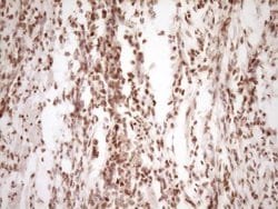 Invitrogen LPIN1 Monoclonal Antibody (OTI8F10) 100 &mu;L; Unconjugated:Antibodies,