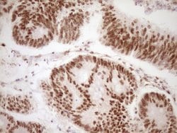 Invitrogen LPIN1 Monoclonal Antibody (OTI8F10) 100 &mu;L; Unconjugated:Antibodies,